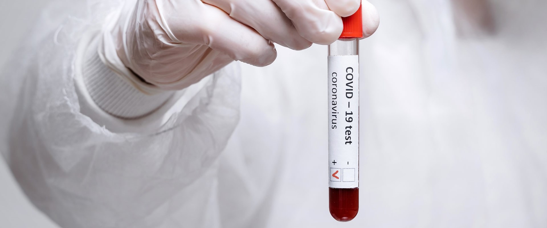 COVID 19 RT-PCR test