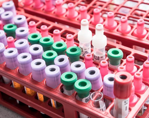 Laboratoř SPADIA LAB spustí společné testování na COVID-19, chřipku A a chřipku B