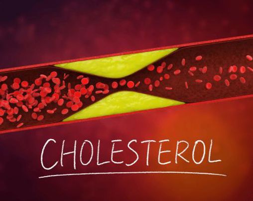 Cholesterol, LDL a HDL – co to znamená a proč si nechat udělat vyšetření?