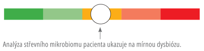 index dysbiózy